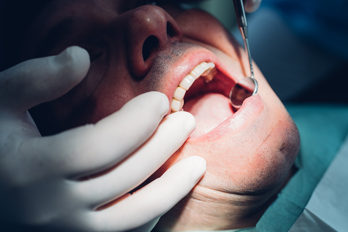 a man getting dental work